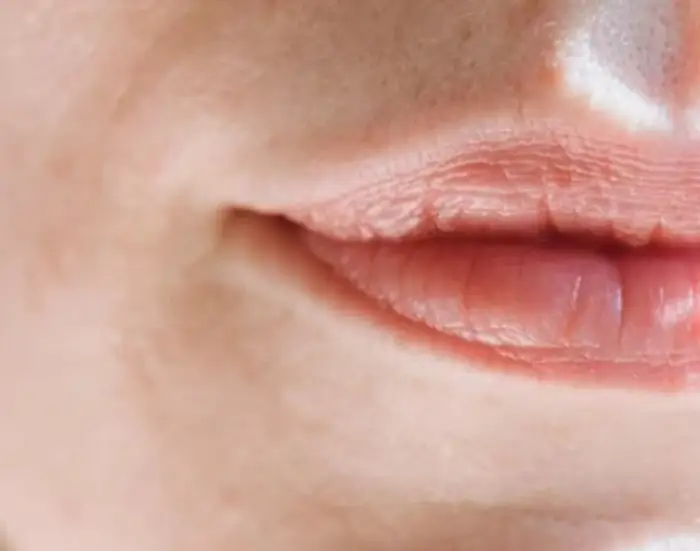 페리덱스 연고 사용법