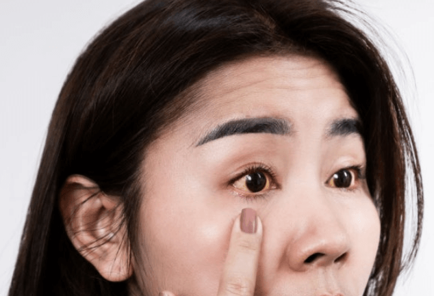 길버트증후군 증상