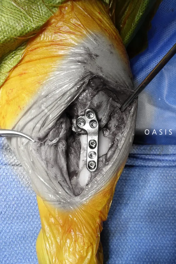 강아지 백내장 수술비용 현실 증상 예방법 보호자 가이드 정리_7