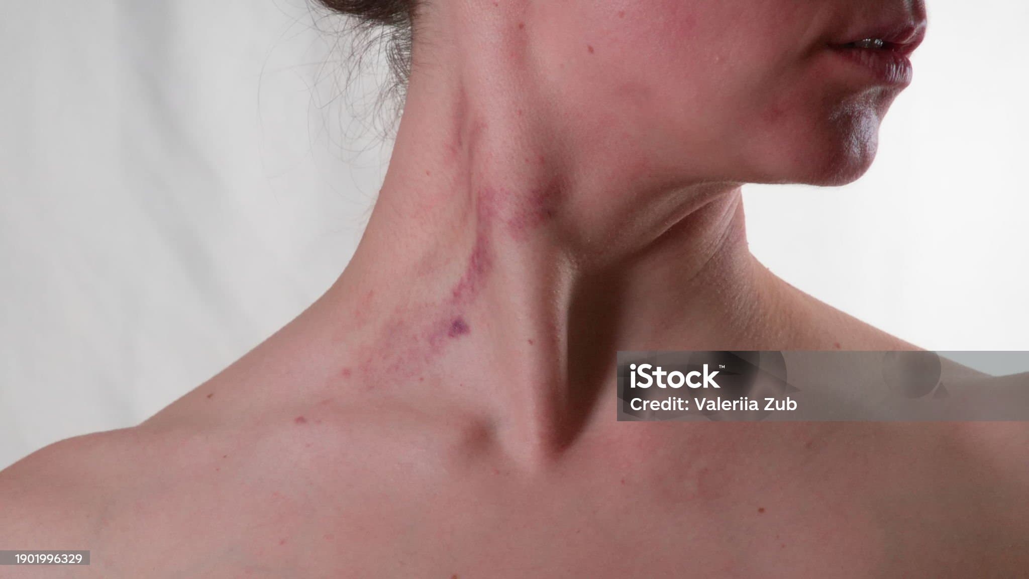 목에 멍울이 잡힐때&amp;#44; 그냥 두면 위험할까요?