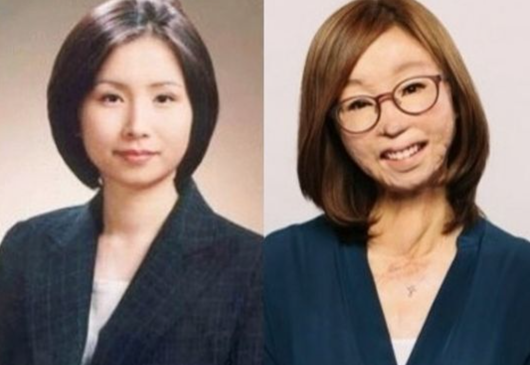 이지선 교수 화상 전