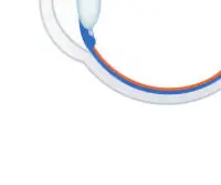 녹내장 초기 증상 &mdash; 시야를 서서히 빼앗는 침묵의 질환