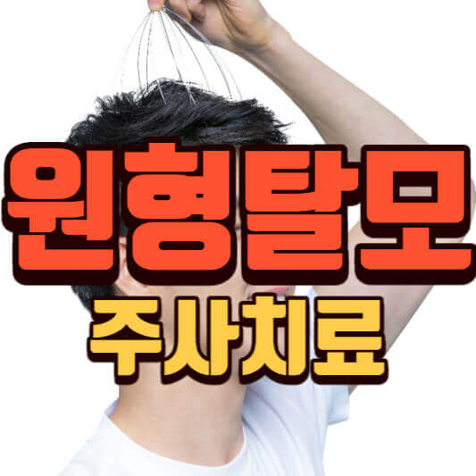 원형탈모 원인 치료 주사