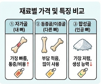 임플란트 재료별 가격 차이