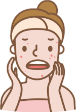 애크린겔 좁쌀여드름