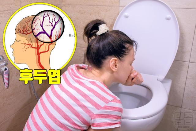 여자 뇌졸중 증상 특징 메스꺼움 구토