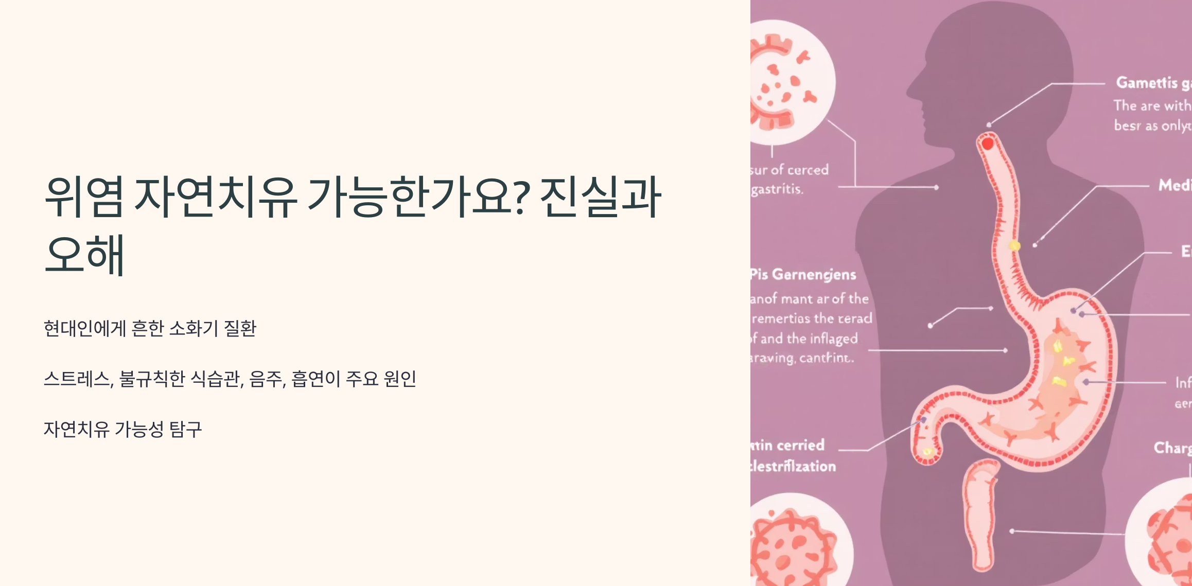 위염의 자연치유의 타이틀에 대해 표현한 이미지