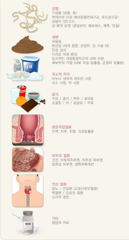 항문 가려움증, 당신이 알아야 할 5가지 사실1