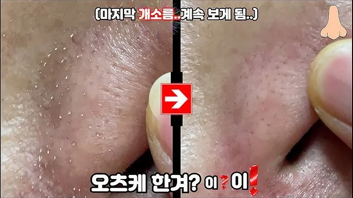 남자 얼굴 피지 제거 화장품 꿀템_4