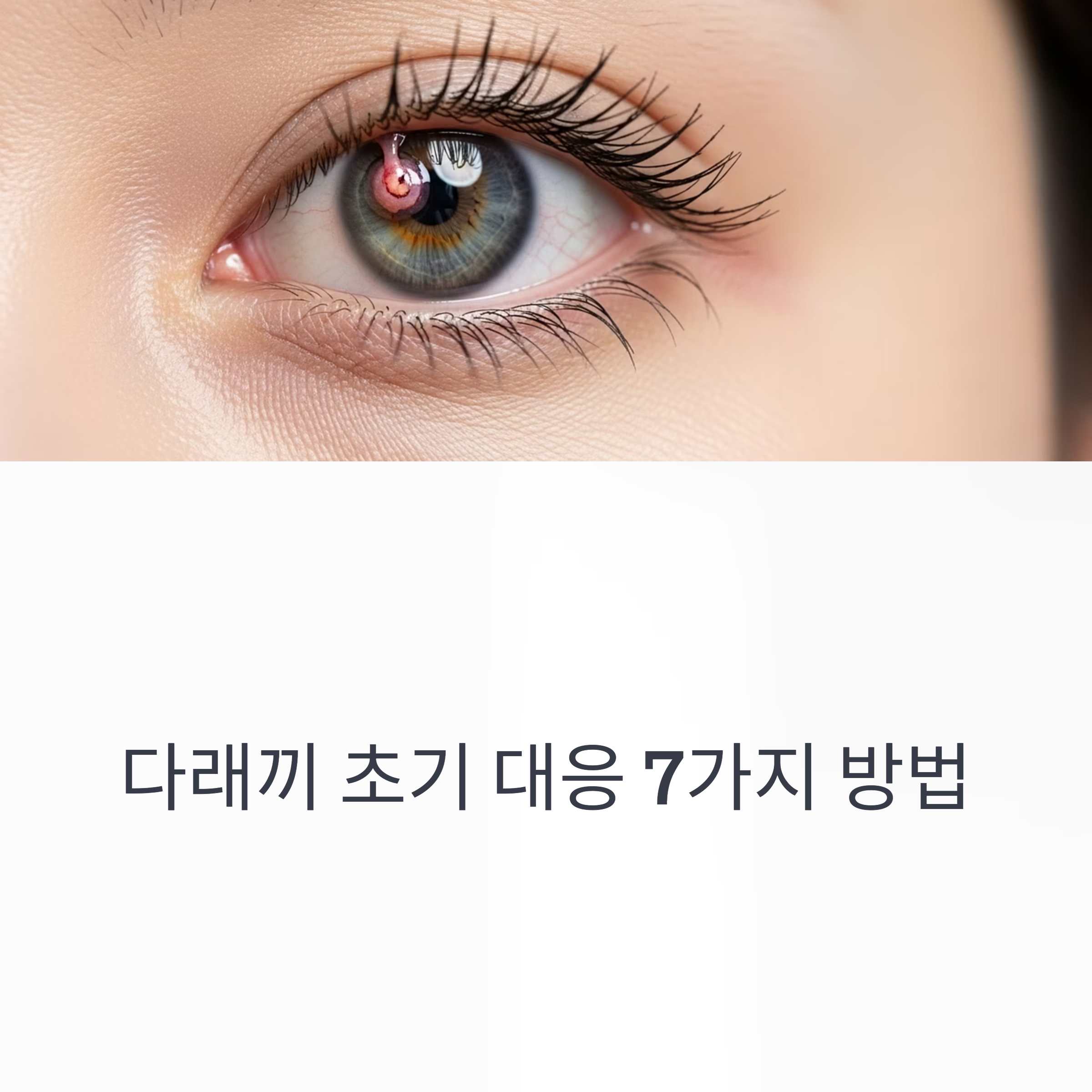 다래끼 초기 대응 7가지 방법