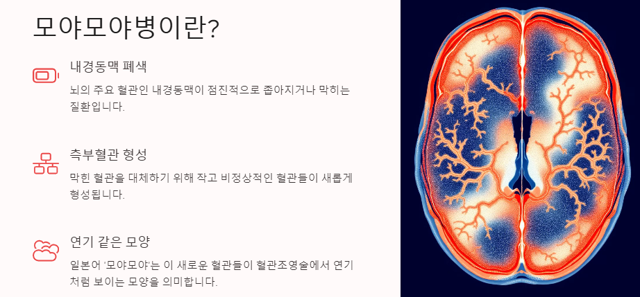모야모야병이란? 원인, 증상, 치료 및 관리(수술 및 좋은음식)