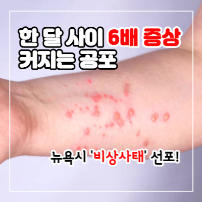 원숭이 두창 초기 증상 및 감염 경로