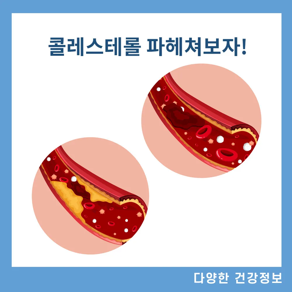 콜레스테롤 정상 수치 낮추는 방법 음식