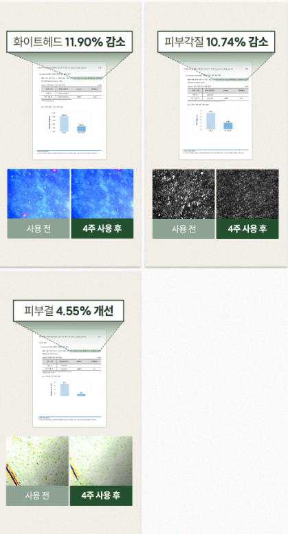 천비누솝 정안고