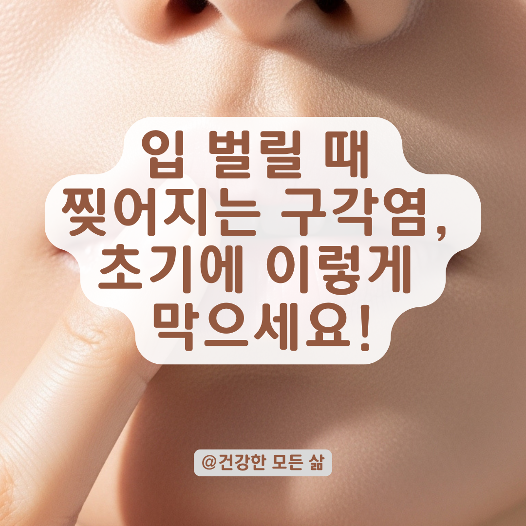 입 벌릴 때마다 더 찢어진다면? 구각염 진행 막는 초기 대응법.