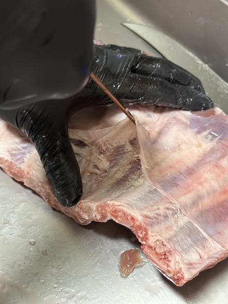 스페어립 근막 제거