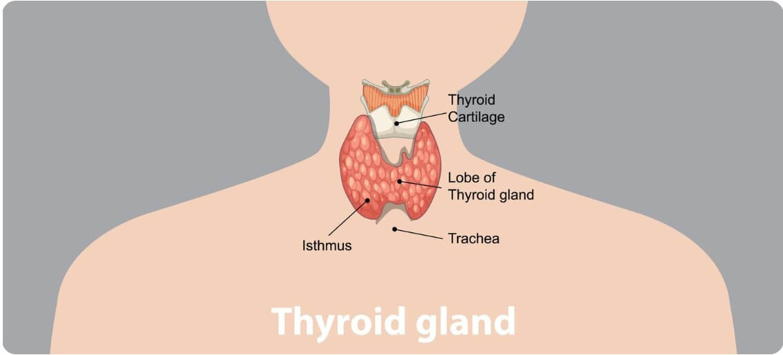 갑상선 기능 항진증에 대해 설명하는 그림