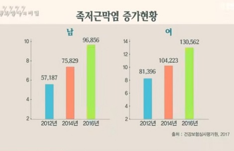 족저근막염