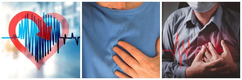 부정맥 관련 사진 3개
