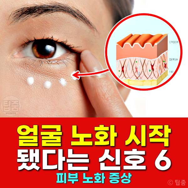얼굴 노화 증상,피부노화 증상,눈밑주름 보톡스