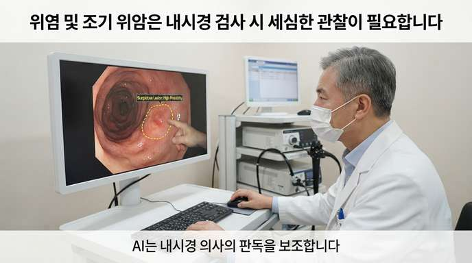 AI 위내시경 조기위암 판독