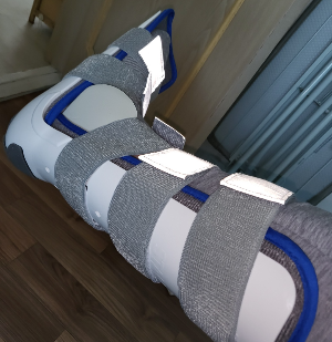 발목 염좌 원인부터 치료와 회복기간