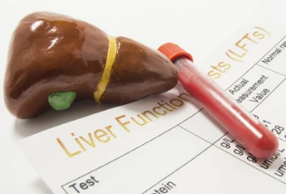 밀크씨슬 부작용