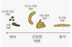 대변 모양과 건강