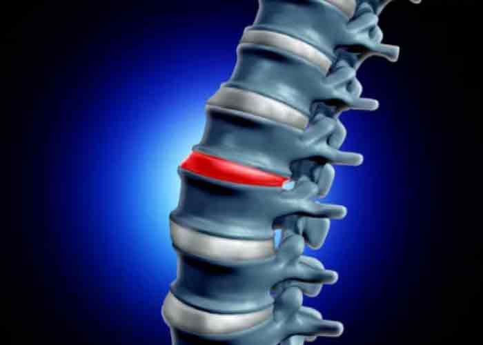 퇴행성척추관협착증 수술과 비수술 치료 선택 기준