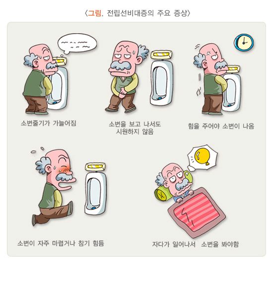 전립성비대증