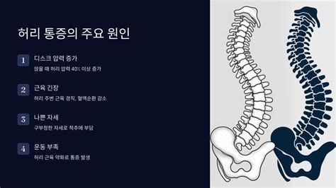 허리가 아픈 이유