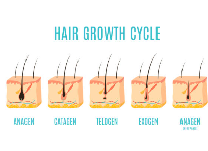 여성 탈모 종류