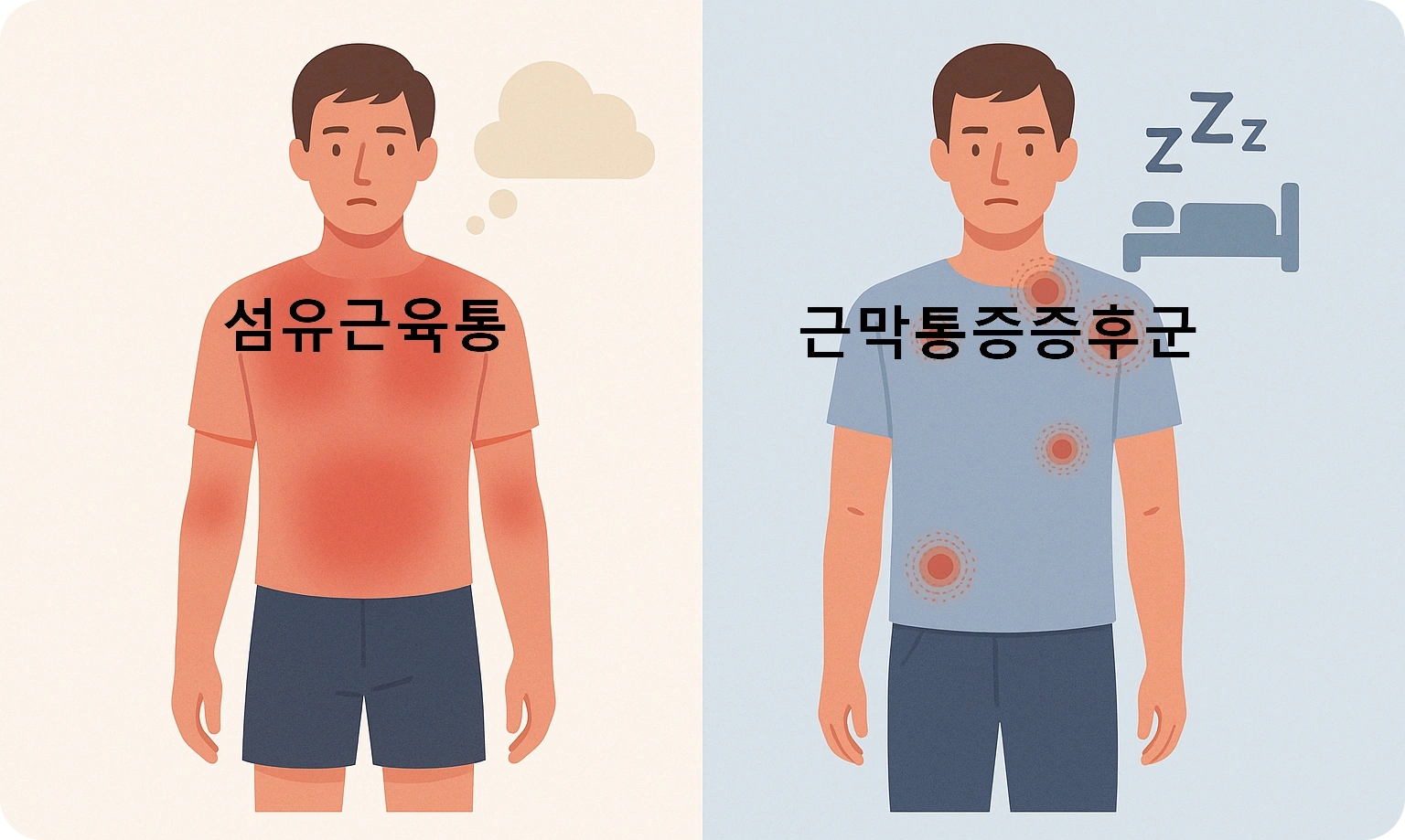 섬유근육통과 근막통증증후군의 차이