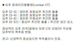 허리디스크 증세