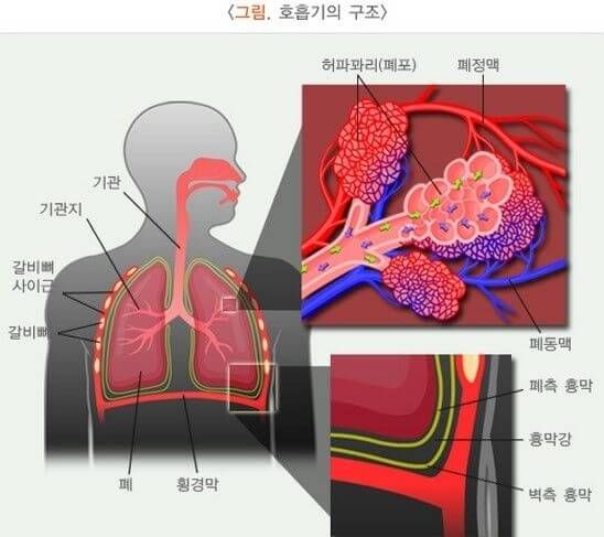 호흡기 질환: 기흉- 증상, 원인, 치료방법, 재발원인, 후유증.