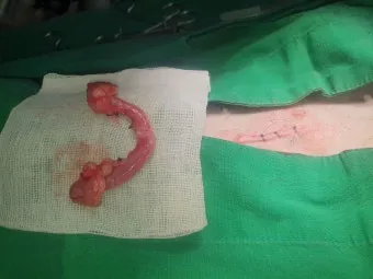 강아지 백내장 수술비용 현실 증상 예방법 보호자 가이드 정리_23