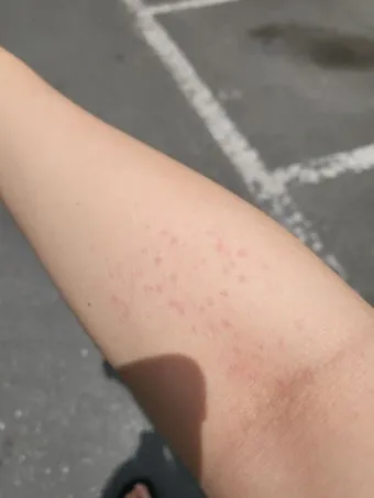 고양이 털 알레르기 완화 방법과 생활 관리 팁_10