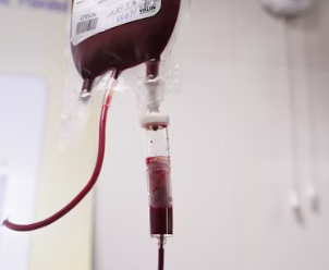 빈혈 증상 원인 치료 방법