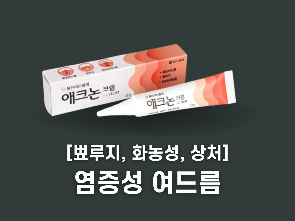염증성 여드름 연고