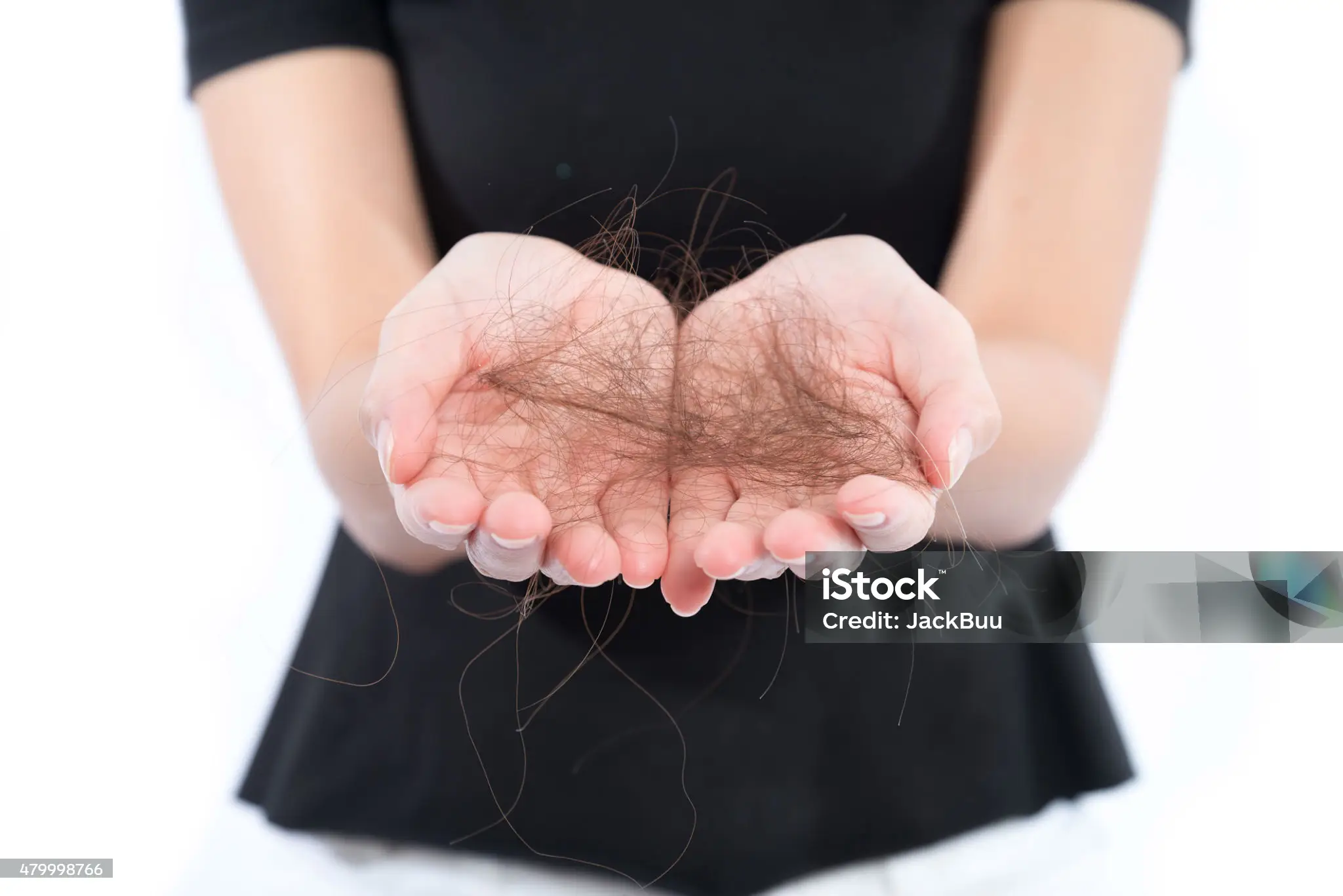 탈모에 좋은 음식 best 10