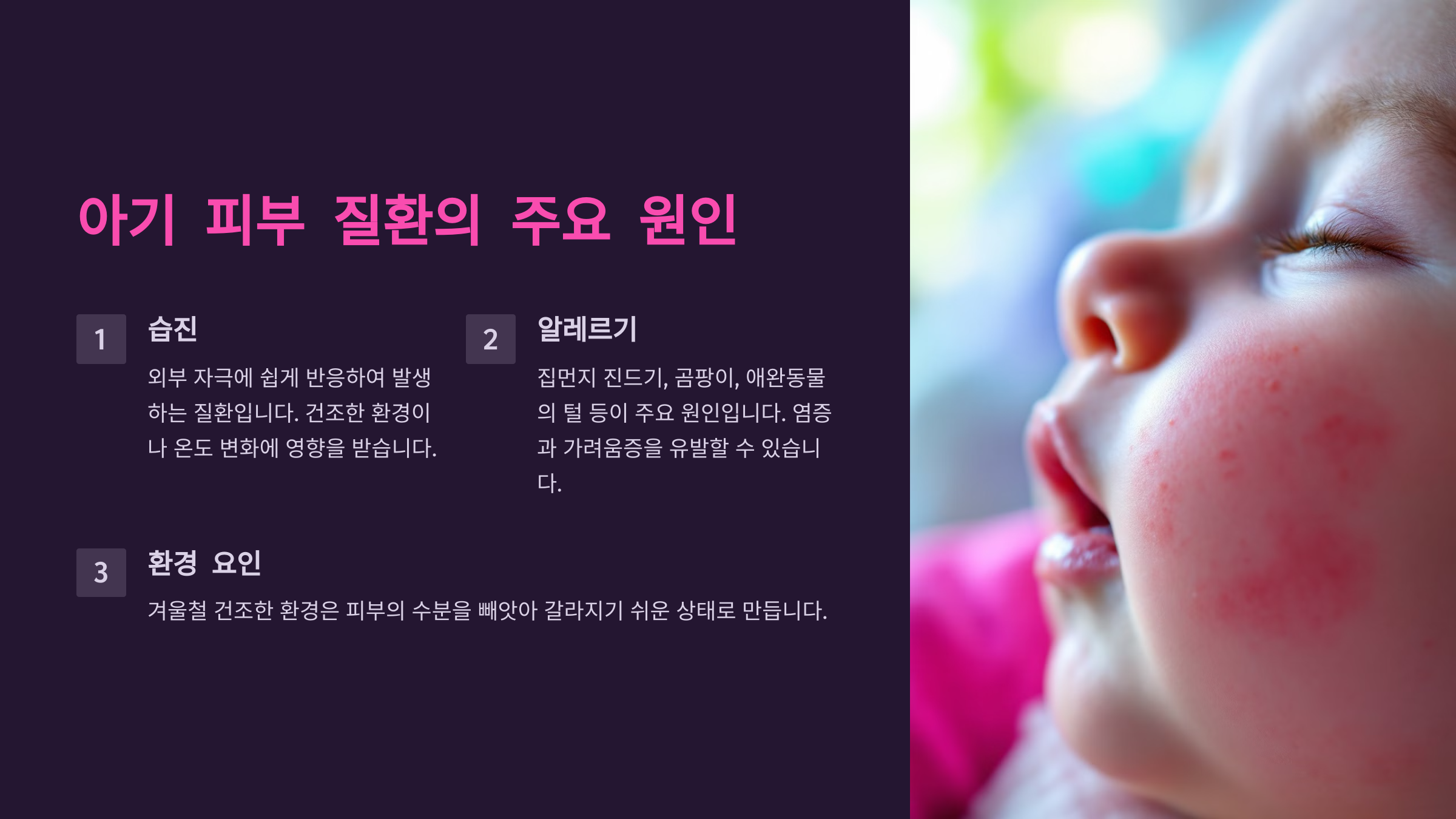 아기 피부 질환의 주요 원인