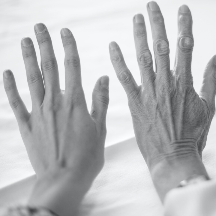 피부 나이 테스트