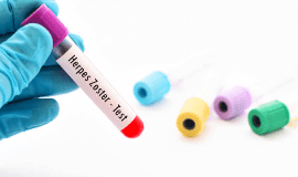 대상포진 예방접종 가격