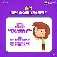 홍역이란 무엇일까