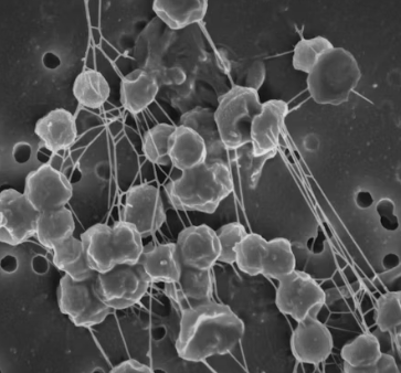 과민성 대장증후군 증상 예방 원인