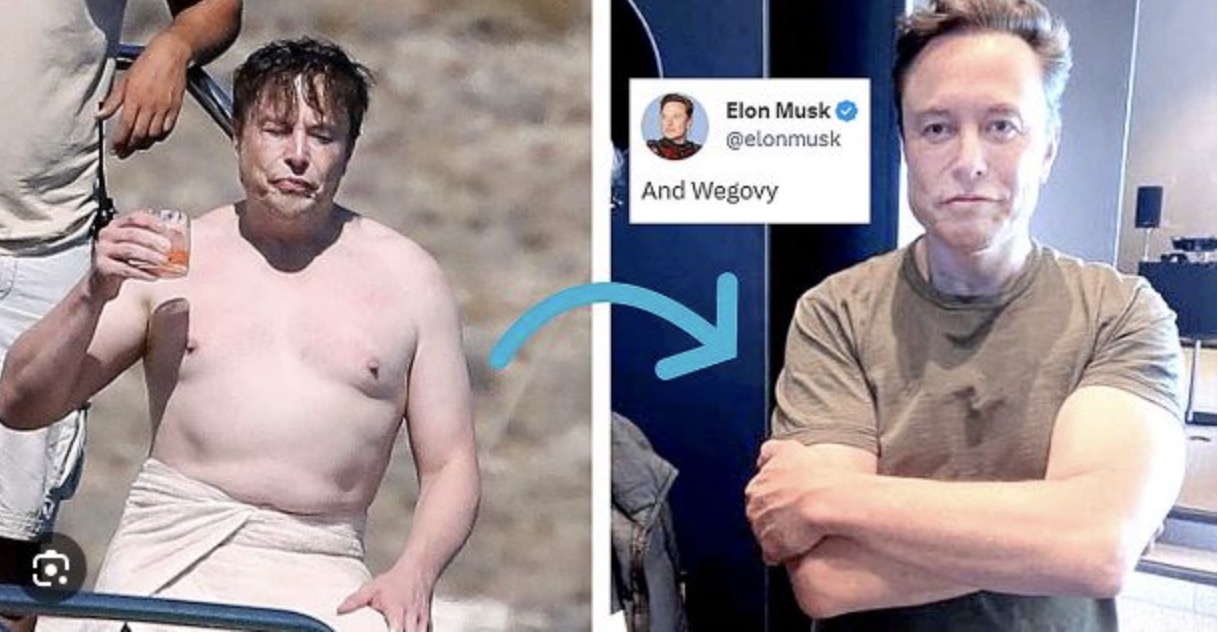 위고비-가격-정보