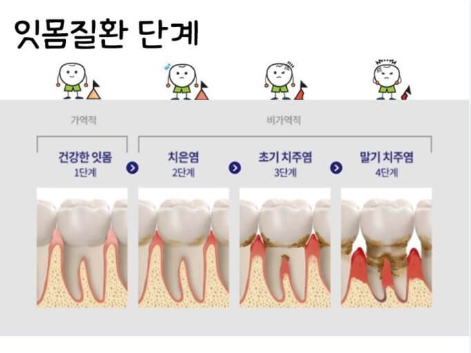 잇몸질환