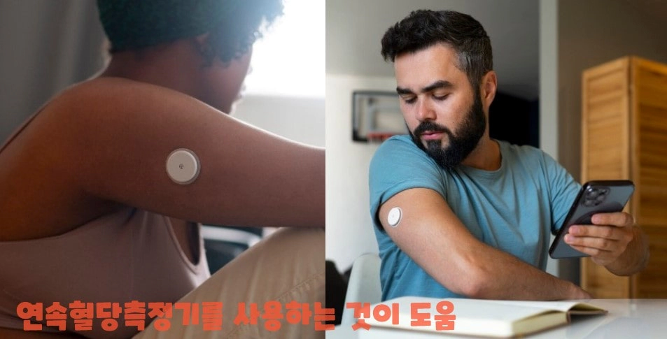 패치형 연속혈당측정기를 팔에 붙인 모습