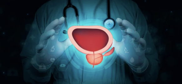 전립선비대증 증상2