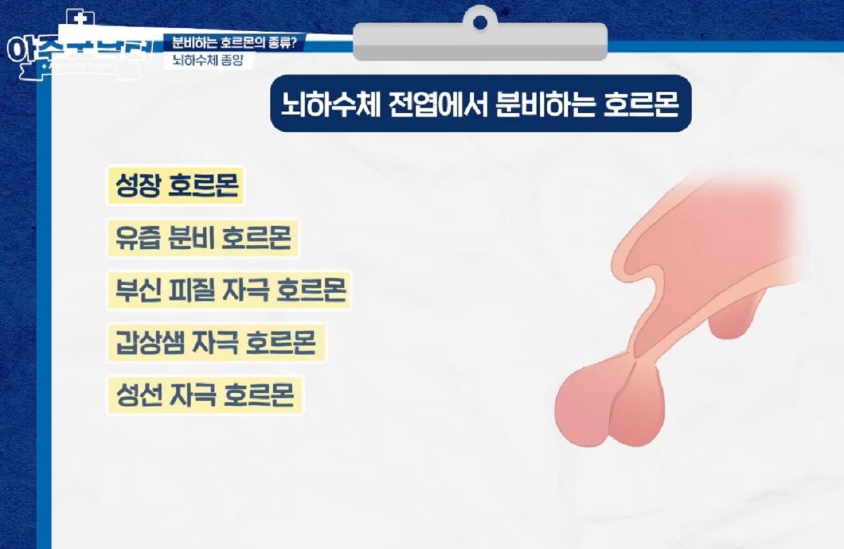 신경외과-김세혁-교수